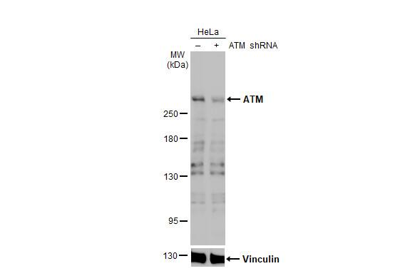 ATM Antibody (2C1-RB)