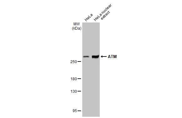 ATM Antibody (2C1-RB) - Azide and BSA Free