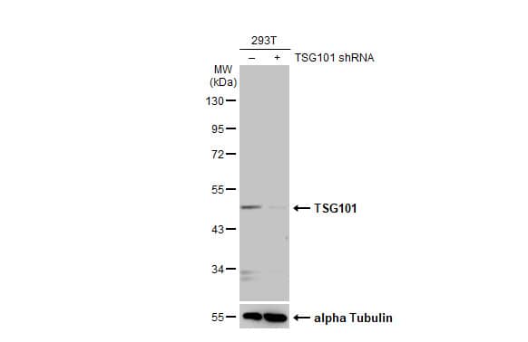 TSG101 Antibody (4A10-RB)
