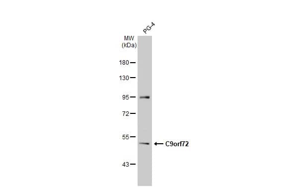 C9orf72 Antibody (GT779-RB)