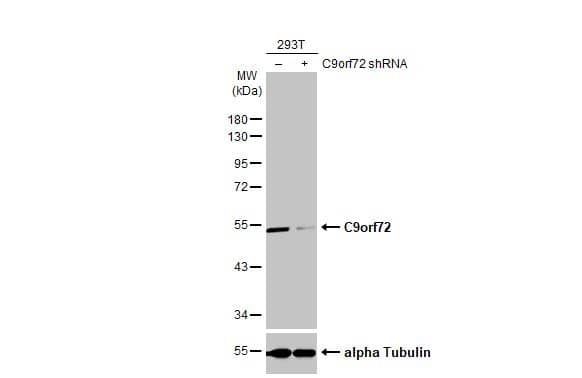 C9orf72 Antibody (GT1553-RB)