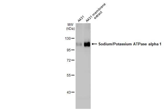 Sodium Potassium ATPase Alpha 1 Antibody (HL114)
