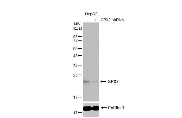 Glutathione Peroxidase 2/GPX2 Antibody (HL125)