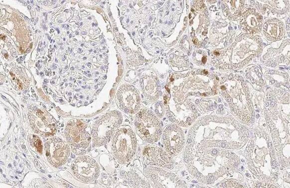 Glutathione Peroxidase 2/GPX2 Antibody (HL125)