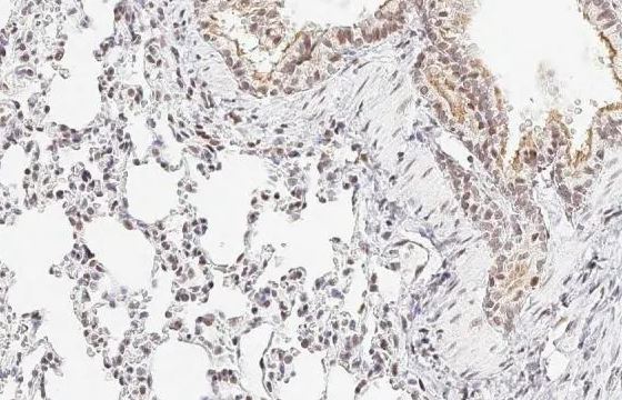 ATR [p Thr1989] Antibody (HL132)