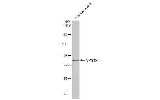 VPS35 Antibody (HL1017)
