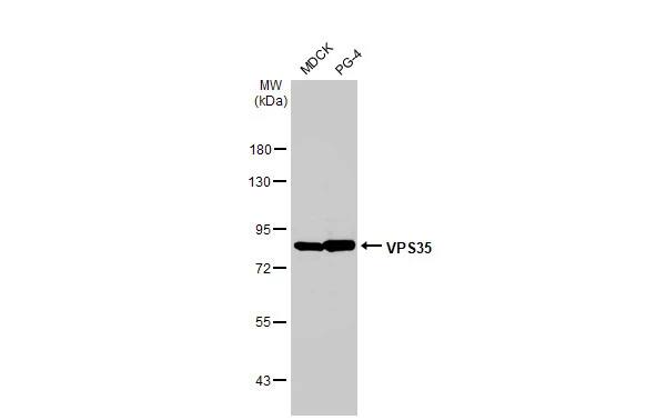 VPS35 Antibody (HL1017)