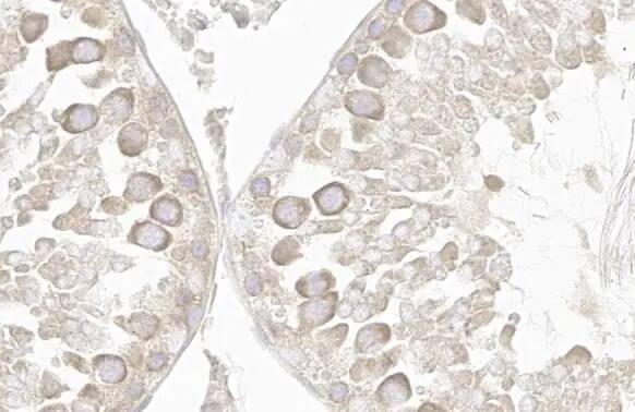 VPS35 Antibody (HL1017)