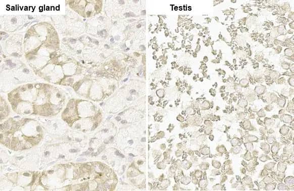 Nrf2 Antibody (HL1021)