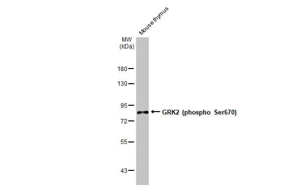 GRK2 [p Ser670] Antibody (HL1035)