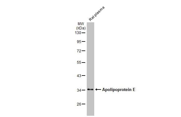 Apolipoprotein E/ApoE Antibody (GT27711)