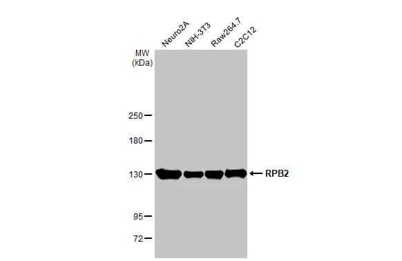 RPB2 Antibody (HL1042)