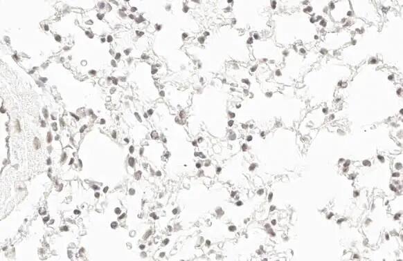 RPB2 Antibody (HL1042)