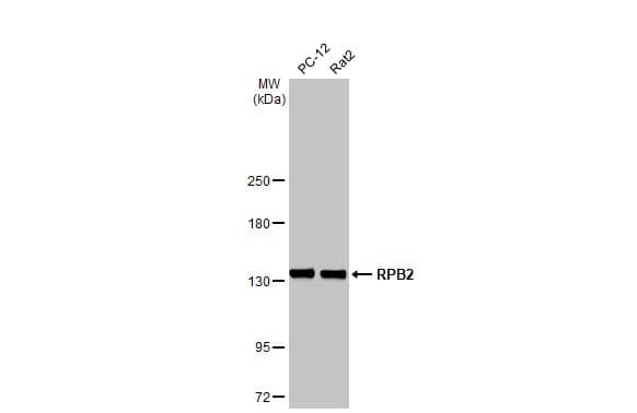 RPB2 Antibody (HL1042)