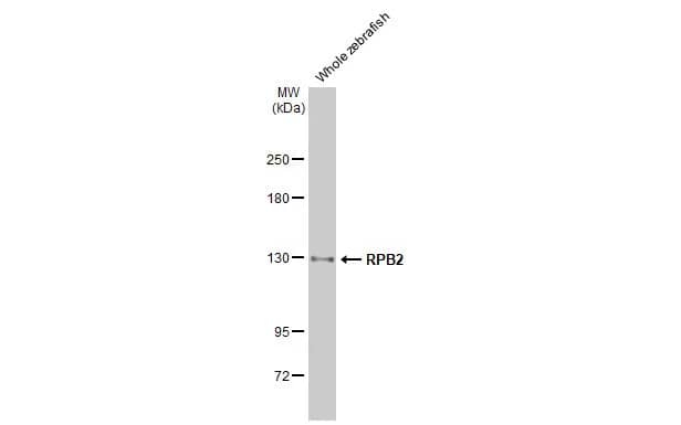 RPB2 Antibody (HL1042)
