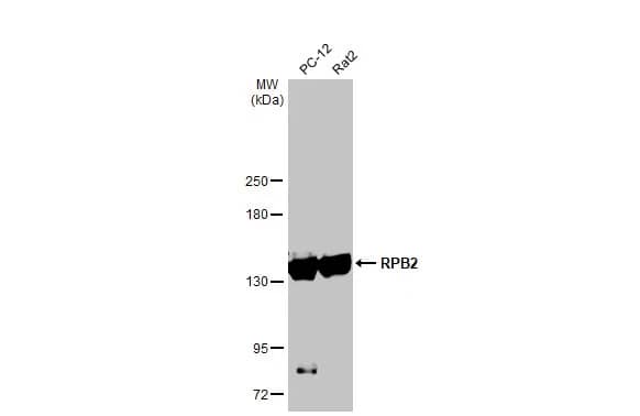 RPB2 Antibody (HL1043)