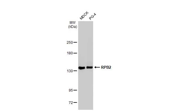 RPB2 Antibody (HL1043)