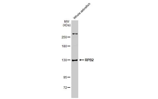 RPB2 Antibody (HL1043)