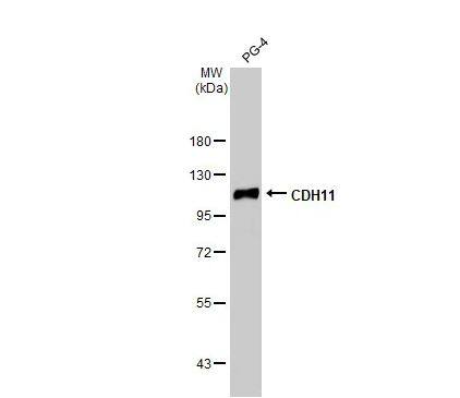 Cadherin-11 Antibody (HL1044)