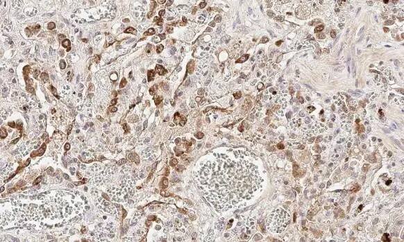 cIAP-1/HIAP-2 Antibody (HL1045)