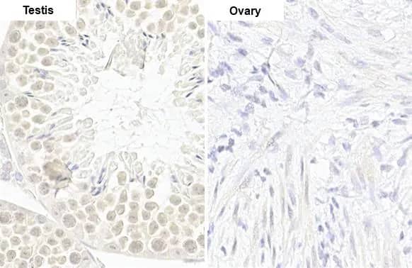 cIAP-1/HIAP-2 Antibody (HL1045)