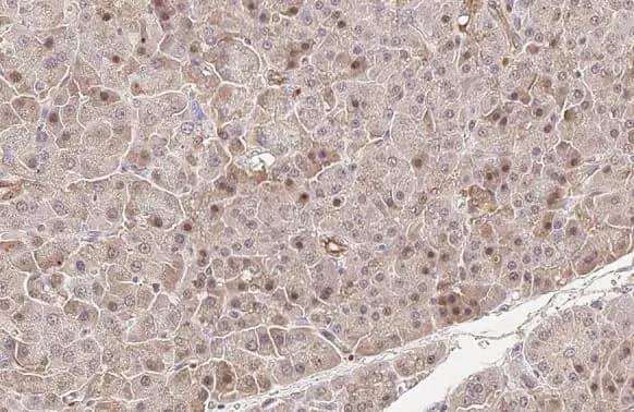 cIAP-1/HIAP-2 Antibody (HL1045)