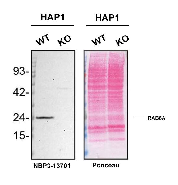 RAB6A Antibody (HL1047)