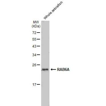 RAB6A Antibody (HL1047)