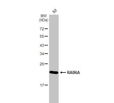 RAB6A Antibody (HL1047)