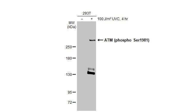 ATM [p Ser1981] Antibody (HL1062) - Azide and BSA Free