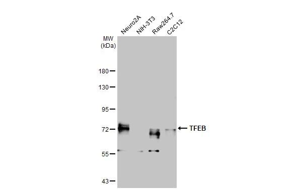 TFEB Antibody (HL1065)