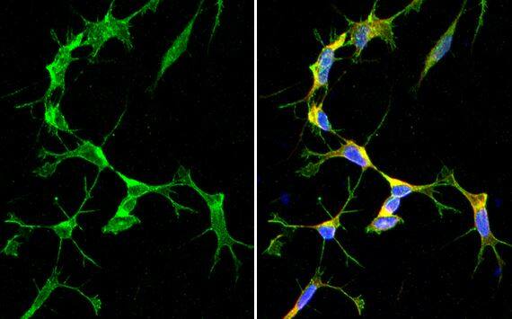 SARM1 Antibody (HL1066)