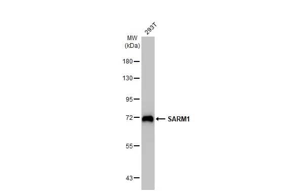 SARM1 Antibody (HL1070)