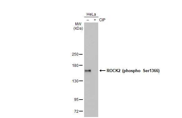 ROCK2 [p Ser1366] Antibody (HL1071) - Azide and BSA Free