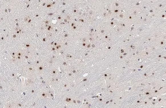 Olig2 Antibody (HL1072)