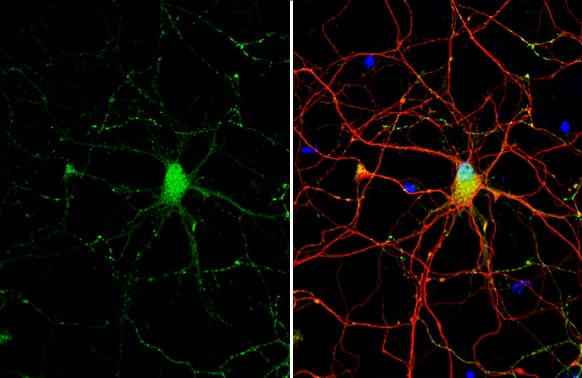Somatostatin Antibody (HL1101)