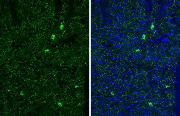Somatostatin Antibody (HL1101)