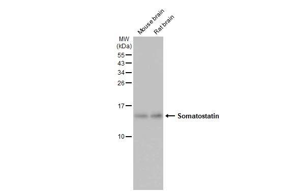 Somatostatin Antibody (HL1101) - Azide and BSA Free
