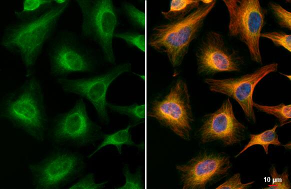 Acetylcholinesterase/ACHE Antibody (HL1102)