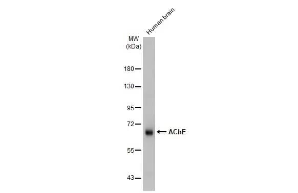 Acetylcholinesterase/ACHE Antibody (HL1102)