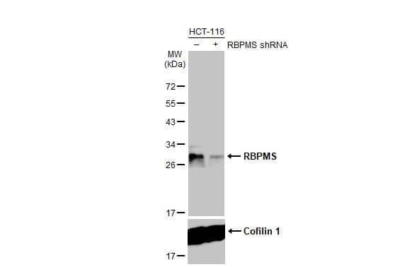 RBPMS Antibody (HL1106)
