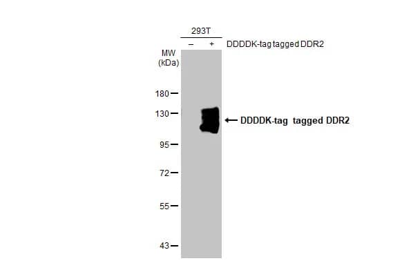 DDR2 Antibody (HL1107)