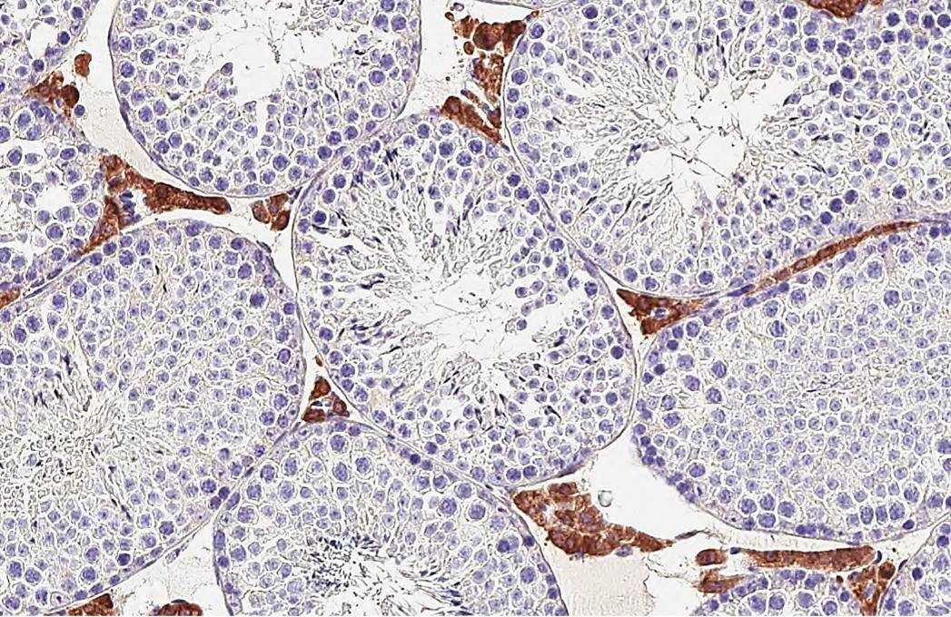 DDR2 Antibody (HL1107) - Azide and BSA Free