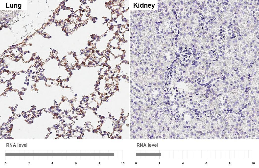 DDR2 Antibody (HL1107) - Azide and BSA Free
