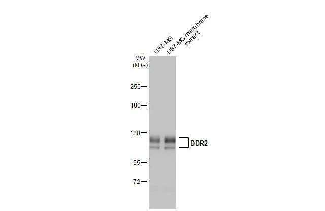 DDR2 Antibody (HL1107) - Azide and BSA Free