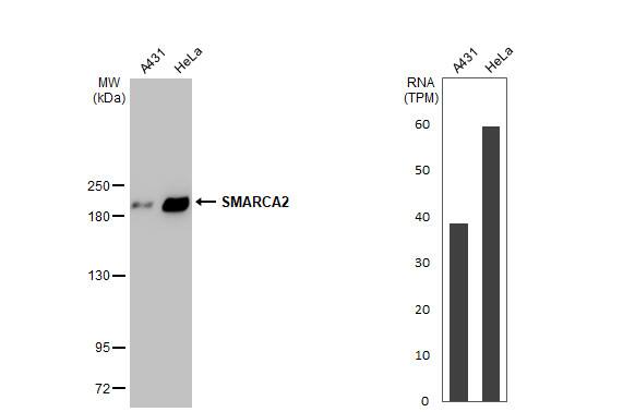 BRM Antibody (HL1115)