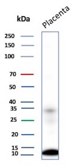 CCL8/MCP-2 Antibody (CCL8/3311) Western Blot: CCL8/MCP-2 Antibody (CCL8/3311) [NBP3-13768] -