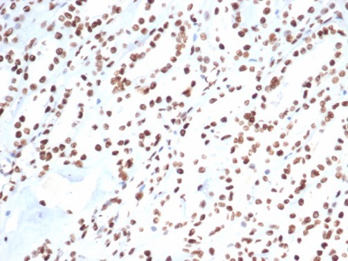 Ku80/XRCC5 Antibody (XRCC5/7317)