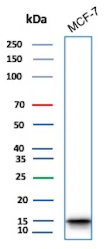 HIST1H3A [p Ser10] Antibody (rPHH3/6824) Western Blot: HIST1H3A [p Ser10] Antibody (rPHH3/6824) [NBP3-13802] -
