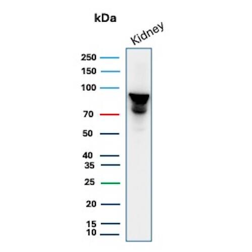 MICA Antibody (MICA/4442) Western Blot: MICA Antibody (MICA/4442) [NBP3-13826] -